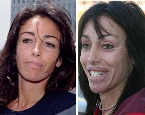 She's apparently hard up for money so Heidi Fleiss sold her plastic surgery 